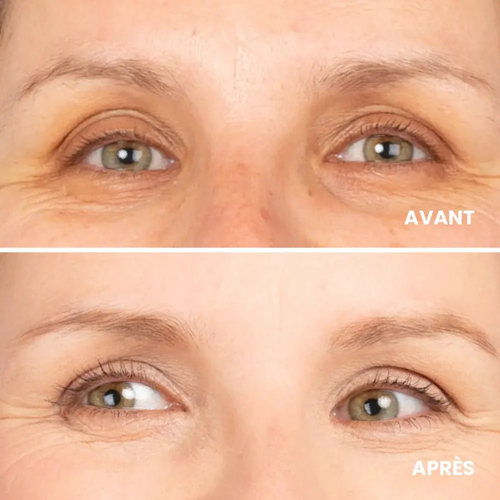Correcteur anti-cernes bio - Image 5